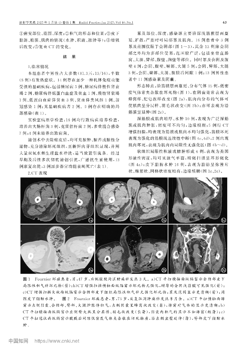 Fournier坏疽的CT表现和诊断_梁惠康-图片-2.jpg