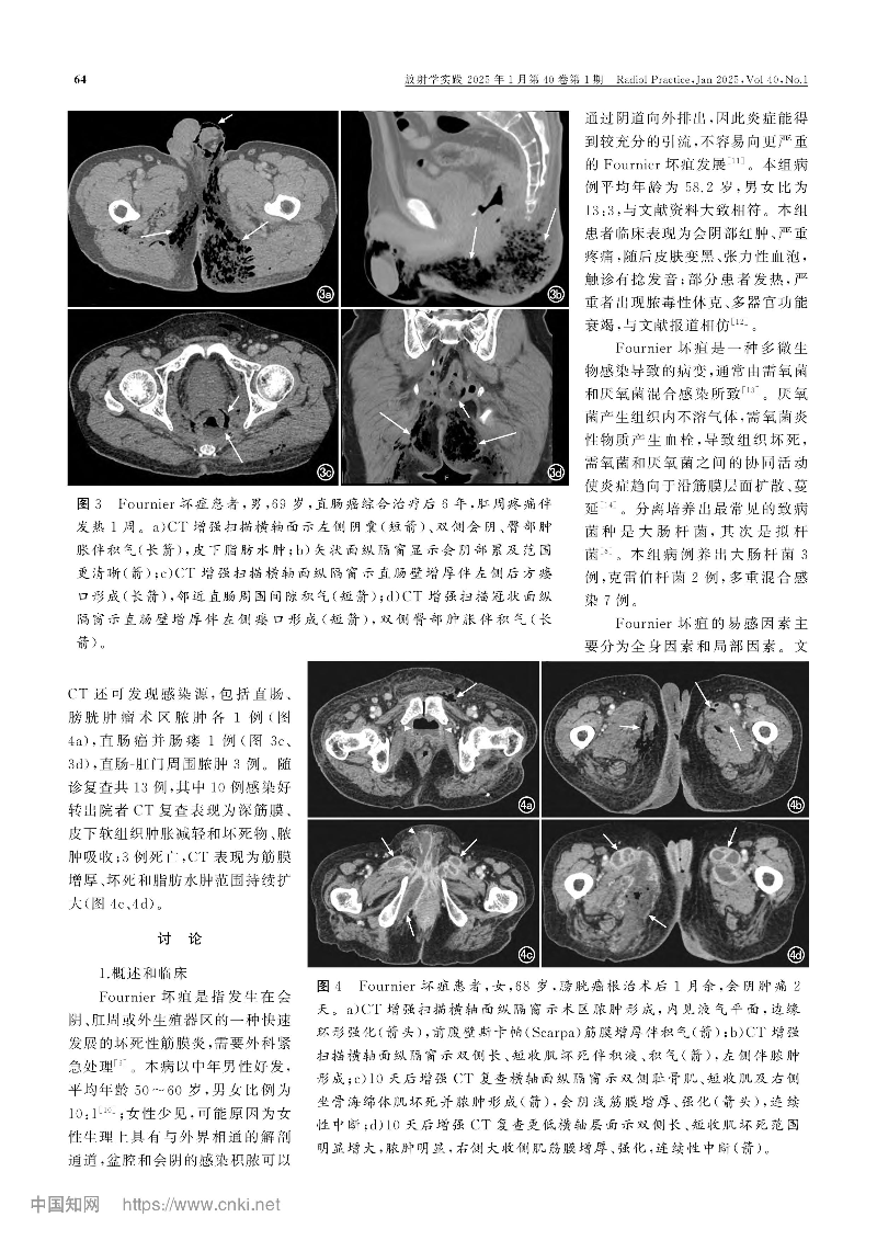 Fournier坏疽的CT表现和诊断_梁惠康-图片-3.jpg